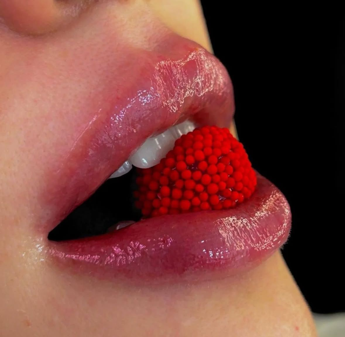 Preenchimento Labial